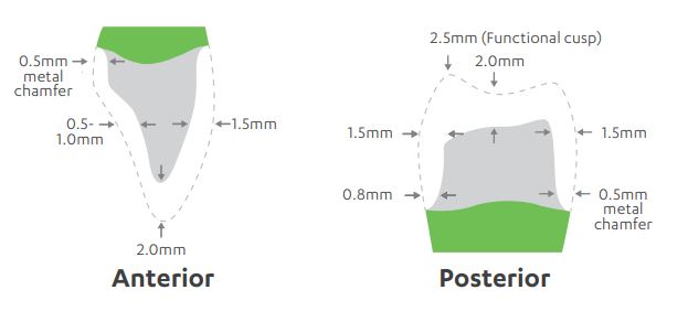 Pfm Crown Preparation PRINCIPLES OF TOOTH PREPARATION PART 7