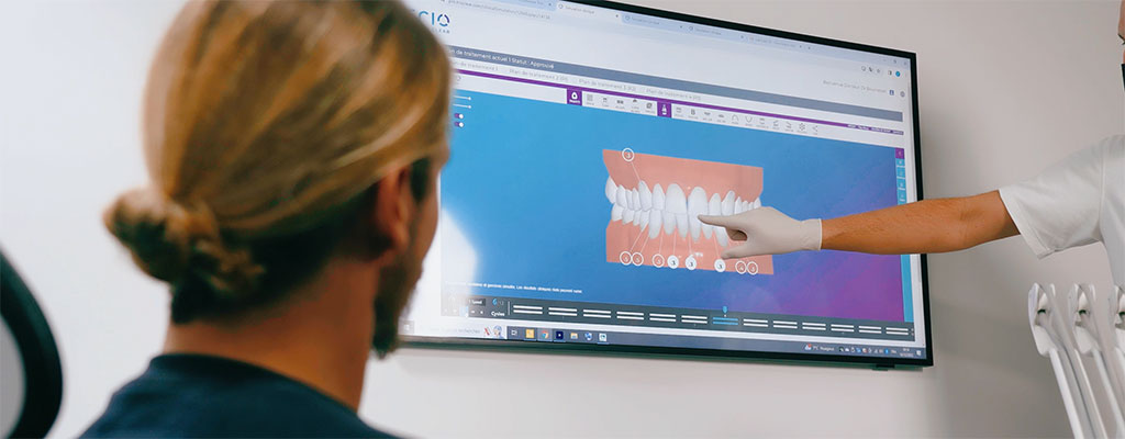 An Introduction to TrioClear™ Clear Aligners (On-Demand)