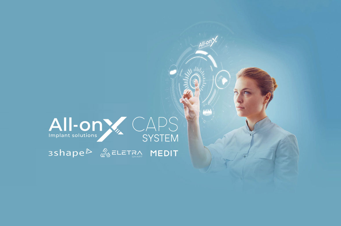 All-on X CAPS System
