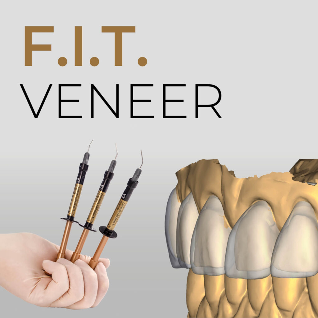 FIT Veneer