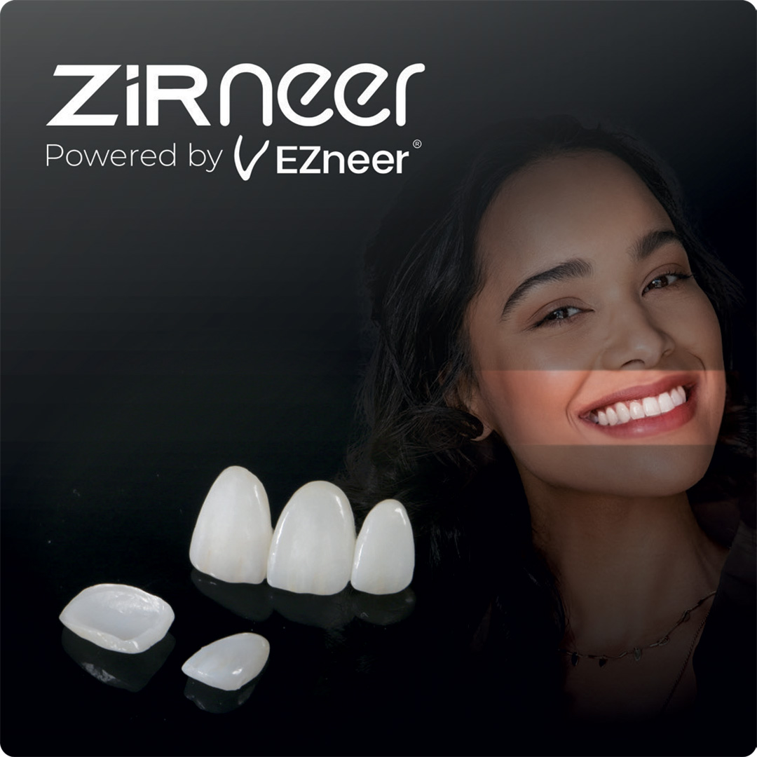 zirneer