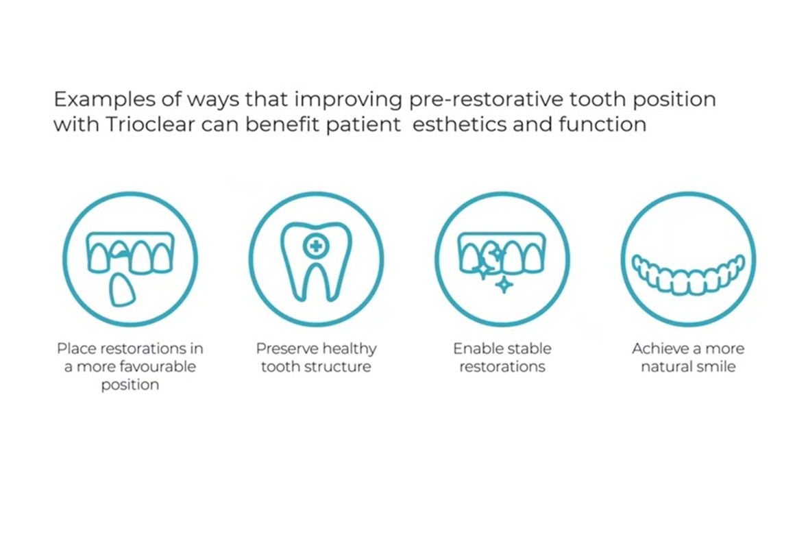 July Webinar: Align & Veneer