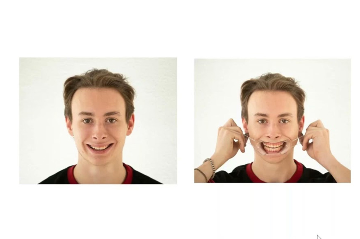 June Webinar: Webinar FIT Veneer 24 June 2025