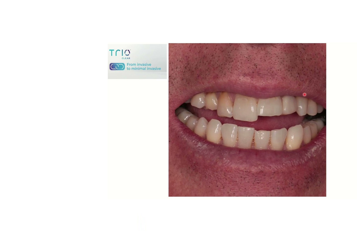 June Webinar: Integrated Smile Design | 25 June 2025