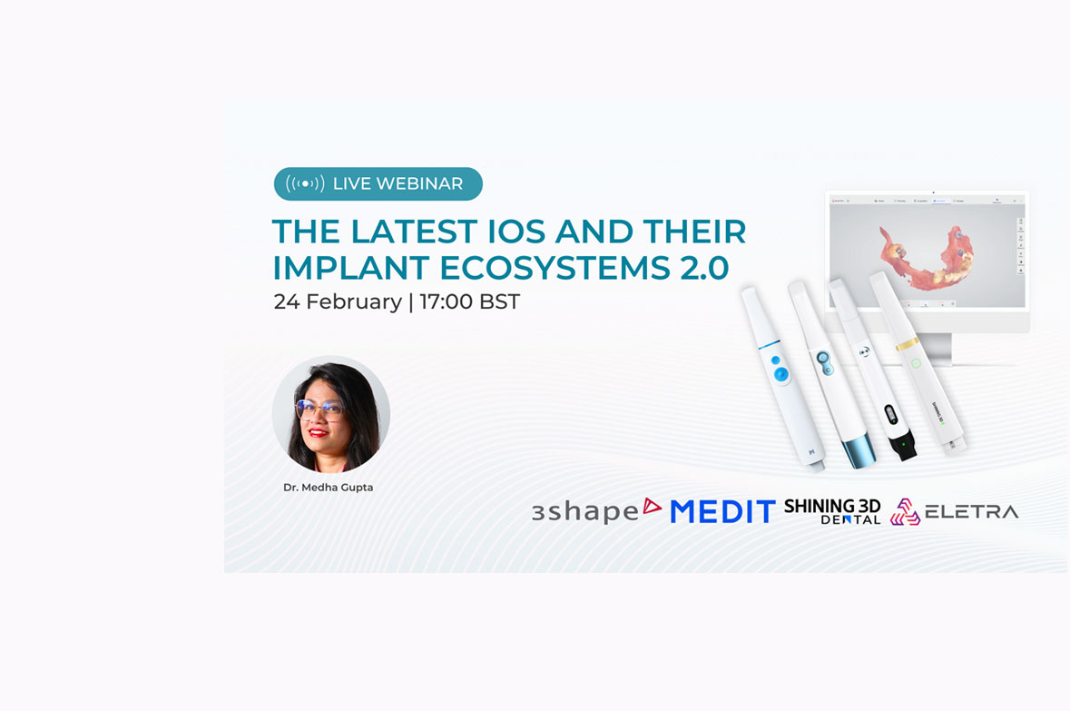 The Latest IOS and Their Implant Ecosystems 2.0