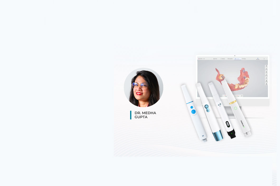 Explore the latest IOS and their Implant Ecosystems