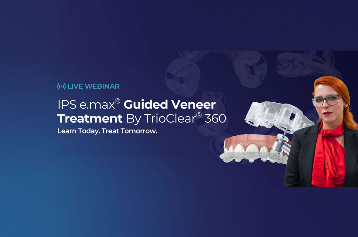 IPS e.max® Guided Veneer Treatment by TrioClear®360