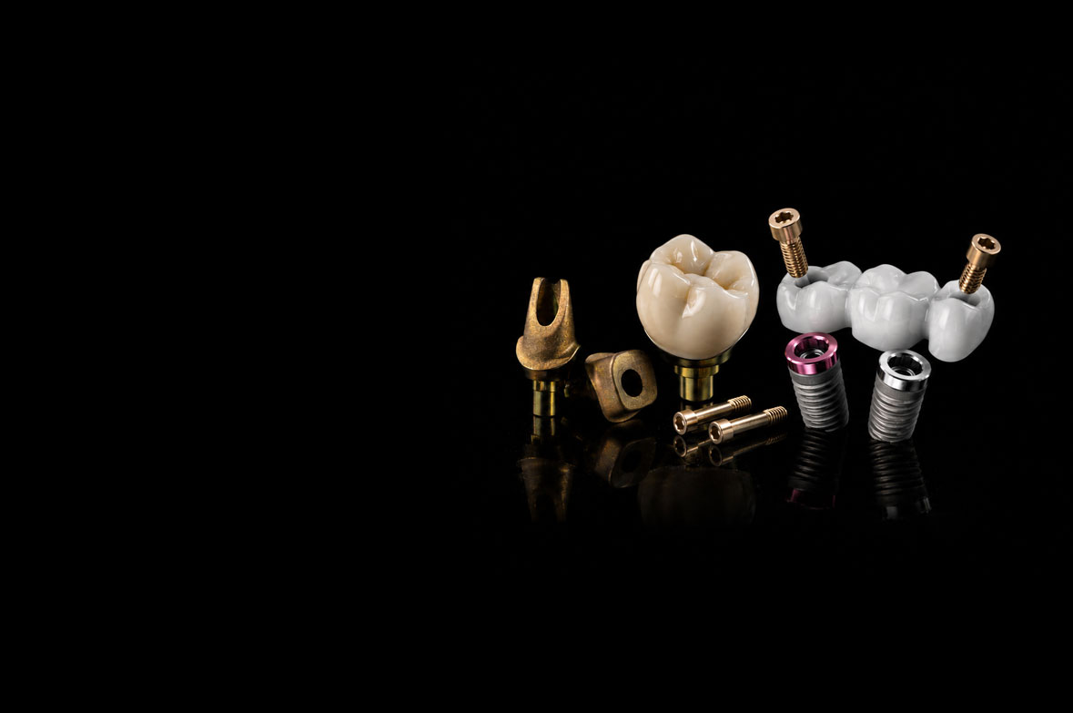 Forma® Implant Crowns and Bridge