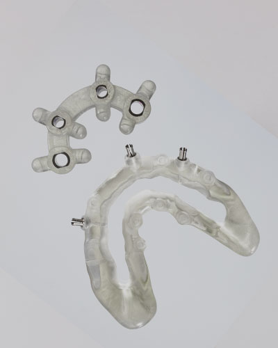 Surgical Guides