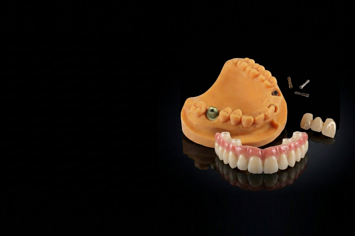 Implant Prosthetics made Simple with Forma® Implant Solutions